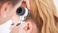 Doctor inspecting patient Scalp with a Dermatoscope